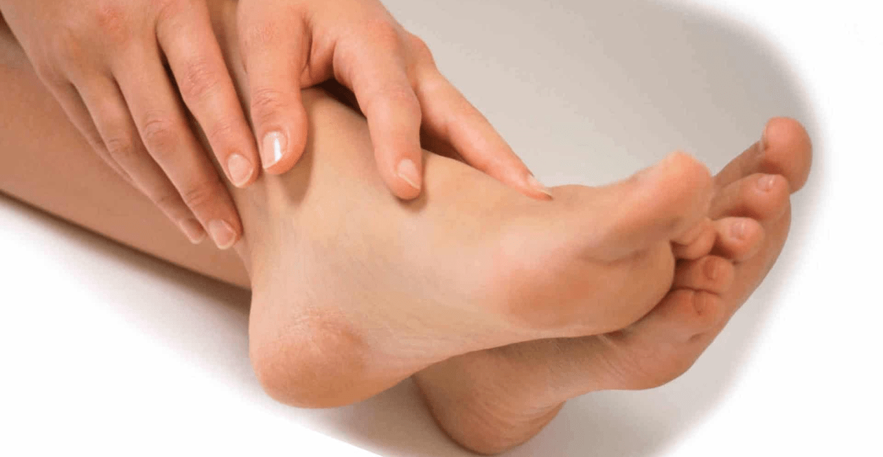 Гъбичната инфекция може да засегне кожата между пръстите на краката