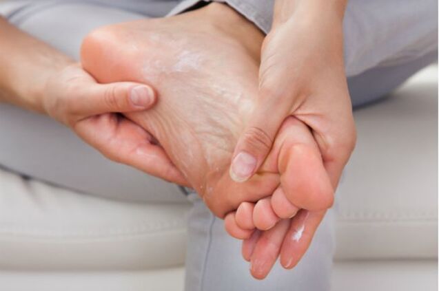 Противогъбичните кремове и капки ще помогнат в началния стадий на гъбички по ноктите на краката