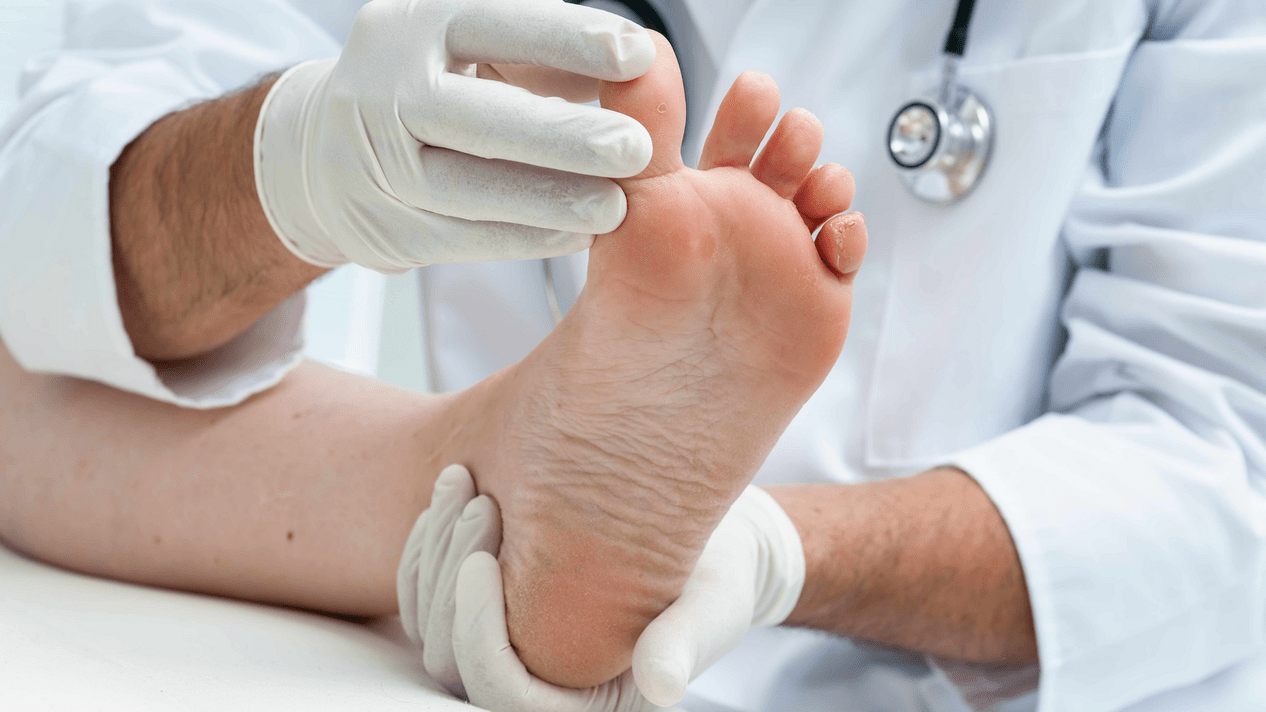 преглед на кожата на краката при уговорка със специалист