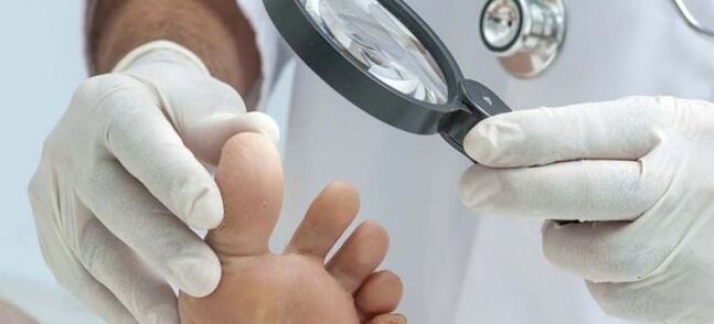 Прегледи преди започване на лечение на гъбички