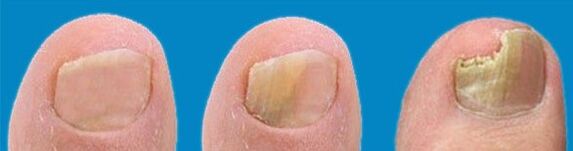 Процес на развитие на гъбички