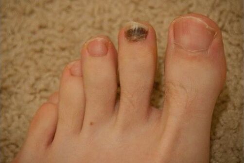 Употреба на перорални и локални лекарства