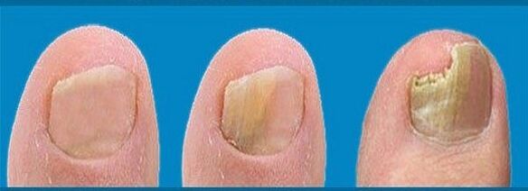 процес на развитие на гъбички